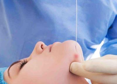 اندولیفت چیست و چه فواید و عوارضی دارد؟